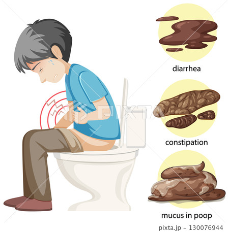 Digestive Health Issues Illustrated in Vector Style 130076944