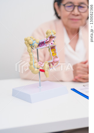 Elderly woman Patient consultation with doctor for Colon disease, Large Intestine, Colorectal cancer, Ulcerative colitis, Diverticulitis, Irritable bowel syndrome, Digestive system and Healthcare 130082366