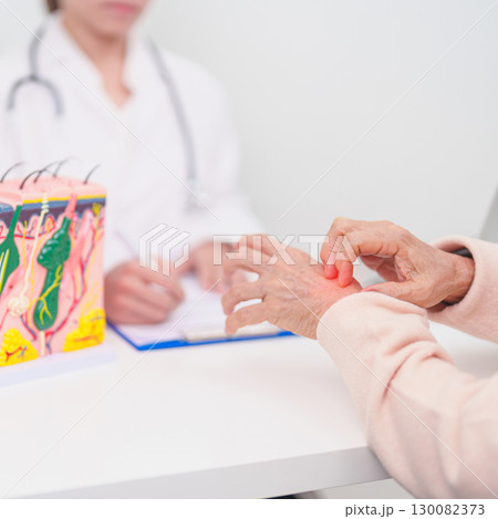 woman Patient consultation Dermatologist with anatomy of skin and hair. Skin disease and Hair loss, Systemic Lupus Erythematosus or SLE, world lupus day, May Melanoma and Skin Cancer Awareness month 130082373