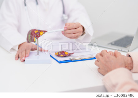 Doctor with human Liver anatomy. Elderly Patient consultation medical health for Liver cancer and Tumor, Jaundice, Viral Hepatitis, Cirrhosis, Failure, Enlarged, Hepatic Encephalopathy, Ascites Fluid Doctor with human Liver anatomy. Elderly Patient consultation medical health for Liver cancer and Tumor, Jaundice, Viral Hepatitis, Cirrhosis, Failure, Enlarged, Hepatic Encephalopathy, Ascites Fluid 130082496