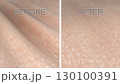 Human skin surface before and after wrinkle reduction treatment. 3D rendered illustration 130100391