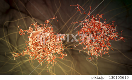 Cervical cancer cells 130105619