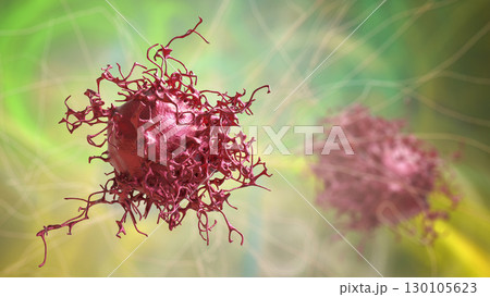 Cervical cancer cells 130105623