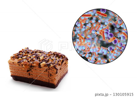 Food borne infections, medical concept 130105915