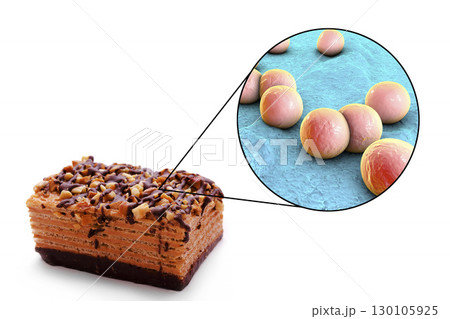 Food borne infections, medical concept 130105925