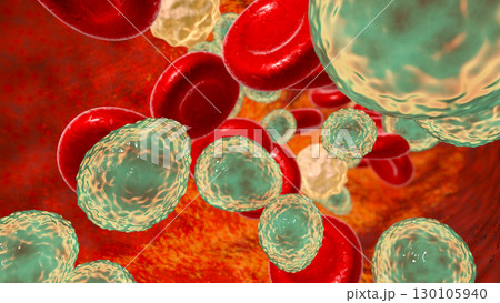 Fungemia, systemic fungal infection, Candida fungi in blood 130105940