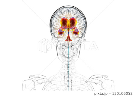 Normal pressure hydrocephalus, 3D illustration Normal pressure hydrocephalus, 3D illustration 130106052