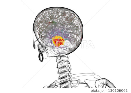 Pons highlighted in human brain, 3D illustration. Pons highlighted in human brain, 3D illustration. 130106061