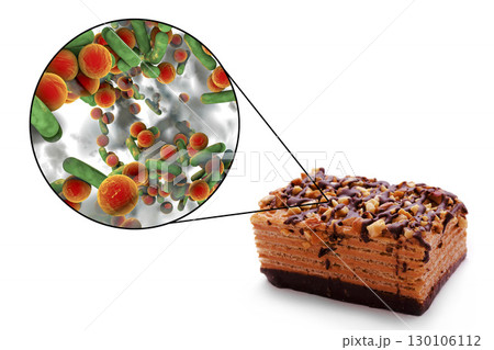 Food borne infections, medical concept 130106112