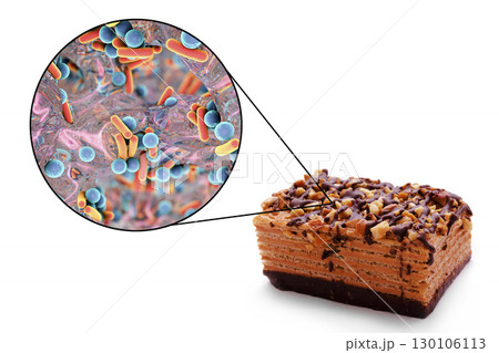 Food borne infections, medical concept 130106113
