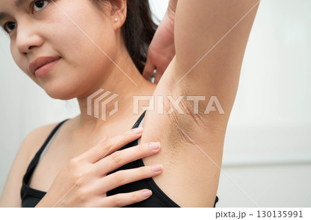 Asian woman have problem black armpit beauty skin care. 130135991