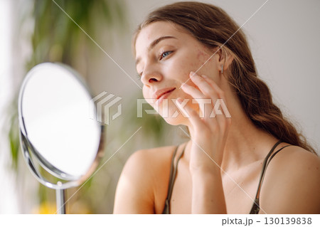Woman worry about her face when she saw the problem of acne occur by a mini mirror. Pimples, acne Woman worry about her face when she saw the problem of acne occur by a mini mirror. Pimples, acne 130139838