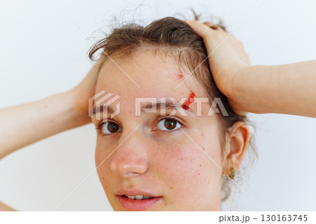 wound blood face woman wound blood face woman 130163745