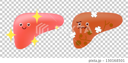 Healthy vs. unhealthy liver 130168501