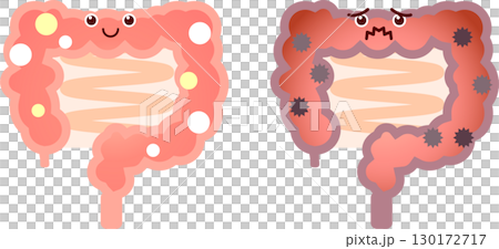 Healthy and unhealthy large intestine 130172717