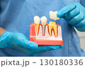 Teeth root dental model with tool for dentist use to cleaning care treatment. 130180336
