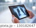 Doctor using tablet analyzing lung X-Ray. Medical Technology. Diagnosis process. Tech support for healthcare.  130182647