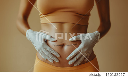 Close-Up of Woman Post-Surgery With Stomach Stitches 130182927