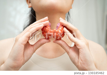 Hyperthyroidism, Overactive Thyroid, Thyroid Lymphoma, Asian woman with thyroid gland human anatomy model. 130185462