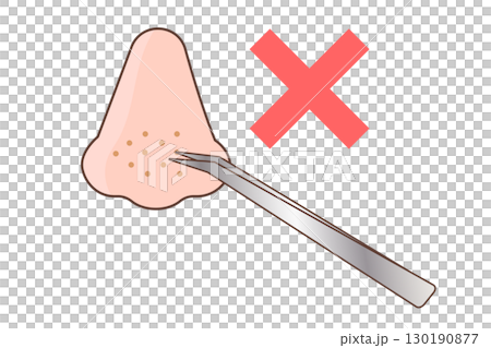Illustration of removing blackheads with tweezers - Wrong care Illustration of removing blackheads with tweezers - Wrong care 130190877