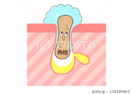 洗顔時の角栓の様子を漫画調に表した断面イラスト 130190883