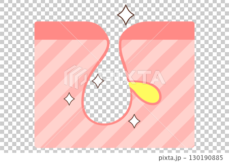 清潔毛孔：去黑頭後的毛孔橫切面 130190885