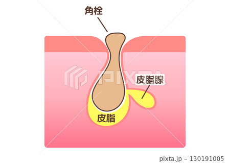 毛穴に角栓が詰まっている様子を示した図解イラスト 130191005