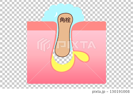 洗顔時に角栓が抜ける様子を表した断面イラスト 130191008