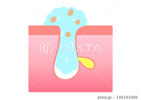 洗顔時の毛穴の様子を表した断面図 130191009