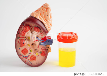 Urinalysis, Kidney and urine cup for check health examination in laboratory. Urinalysis, Kidney and urine cup for check health examination in laboratory. 130204645
