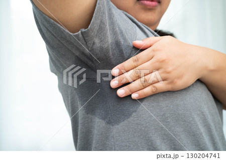 Asian woman have problem black armpit beauty skin care. Asian woman have problem black armpit beauty skin care. 130204741