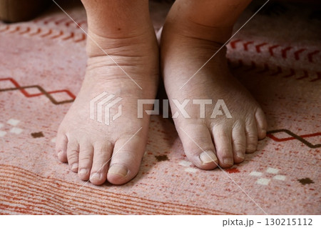 高齢男性の足 130215112
