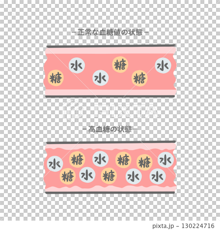 正常な血糖値の血管と高血糖状態の血管の比較イラスト_パステル 130224716