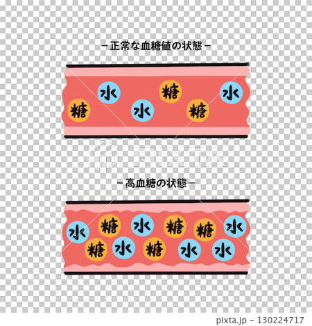 血糖正常和血糖高的血管對比圖 130224717