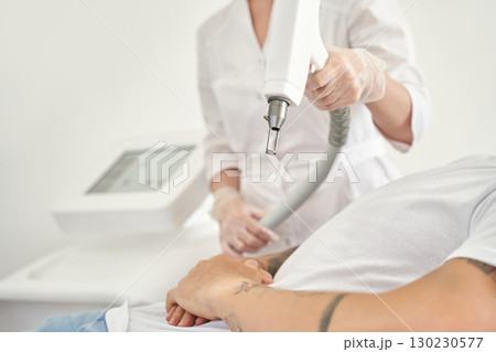 Male undergoing tattoo removal with laser treatment in professional clinic Male undergoing tattoo removal with laser treatment in professional clinic 130230577
