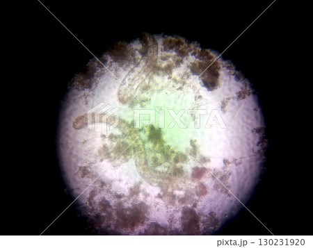Nematode Germs Magnified Under Microscope Showing Structure and Habitat Details Nematode Germs Magnified Under Microscope Showing Structure and Habitat Details 130231920