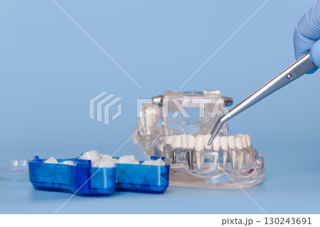 Placing dental prosthetic tooth on jaw model Placing dental prosthetic tooth on jaw model 130243691