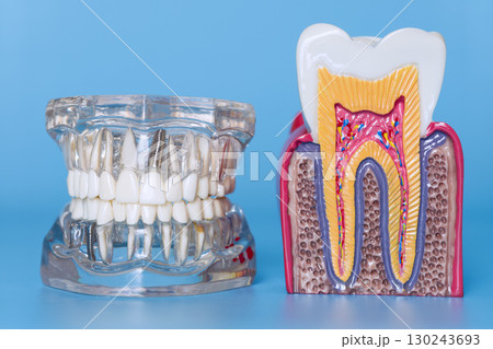 Dental jaw model with implants and healthy tooth anatomy model Dental jaw model with implants and healthy tooth anatomy model 130243693