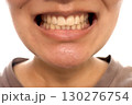 歯列矯正を終えた女性 130276754