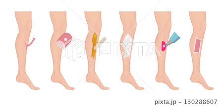 Different methods of hair removal showing legs and tools 130288607