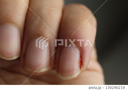Close-up of a woman's hand nails without manicure. Clean hands Close-up of a woman's hand nails without manicure. Clean hands 130290219
