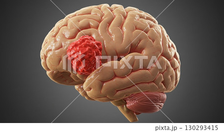 composite image of brain 130293415