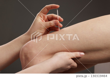 Professional dry needling technique for muscle pain relief, trigger point therapy and sports injury rehabilitation Professional dry needling technique for muscle pain relief, trigger point therapy and sports injury rehabilitation 130319464
