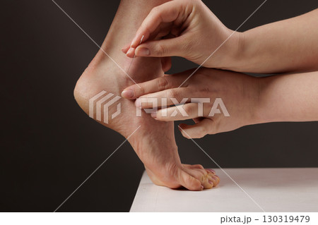 Professional dry needling technique applied to foot for trigger point therapy, pain relief and rehabilitation Professional dry needling technique applied to foot for trigger point therapy, pain relief and rehabilitation 130319479