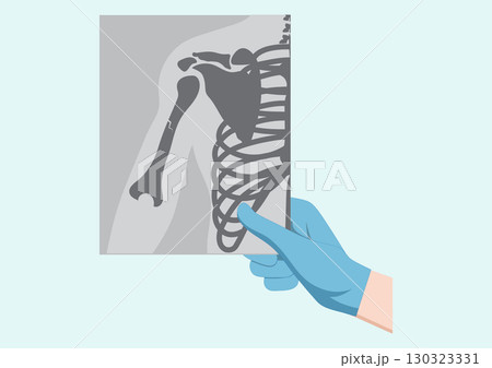 Medical doctor looking at x-ray picture of arm in hospital. Medical doctor looking at x-ray picture of arm in hospital. 130323331