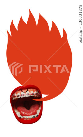 Bold colorful poster. Open mouth with braces shouting red flame shaped speech bubble with copy space Bold colorful poster. Open mouth with braces shouting red flame shaped speech bubble with copy space 130331878