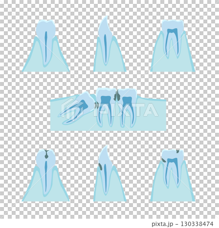 Cross-sectional image of teeth, gums, and cavities Cross-sectional image of teeth, gums, and cavities 130338474