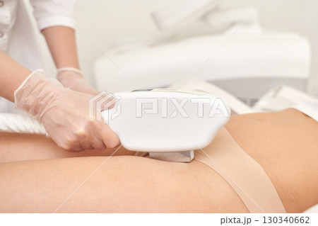 Laser hair removal procedure on female adult caucasian leg in spa setting Laser hair removal procedure on female adult caucasian leg in spa setting 130340662