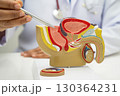 Male reproductive system, Asian doctor holding human anatomy model for study diagnosis and treatment in hospital. 130364231