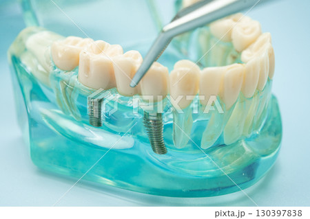Dental teeth model with dentist tool for dentistry. 130397838